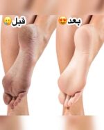 کرم ترک پا و دست برند تاپ لیدی کد T27006 - فروشگاه عمده لوازم آرایشی کالای سید