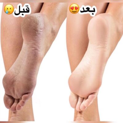 کرم ترک پا و دست برند تاپ لیدی کد T27006 - فروشگاه عمده لوازم آرایشی کالای سید